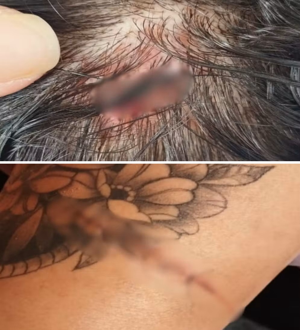 Homem é preso após morder e arrancar parte do dedo de mulher em Auriflama