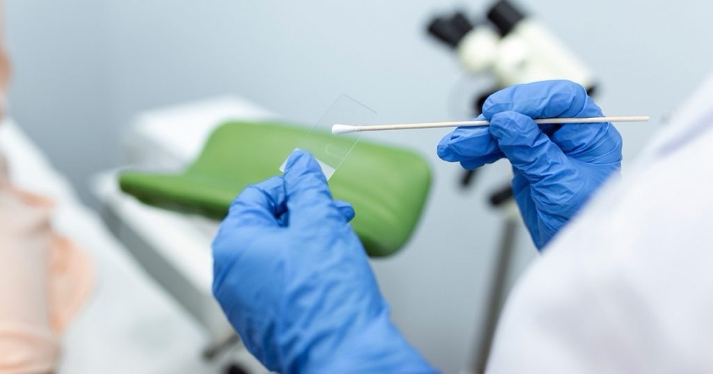 Exame inovador para câncer de colo de útero começa a ser adotado em Ribeirão Preto em parceria com a USP