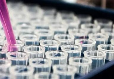 Pesquisas brasileiras avançam no diagnóstico de Alzheimer